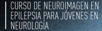 neuroimagen